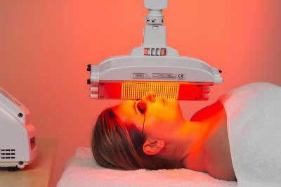 写真：ケミカルピーリング イメージ